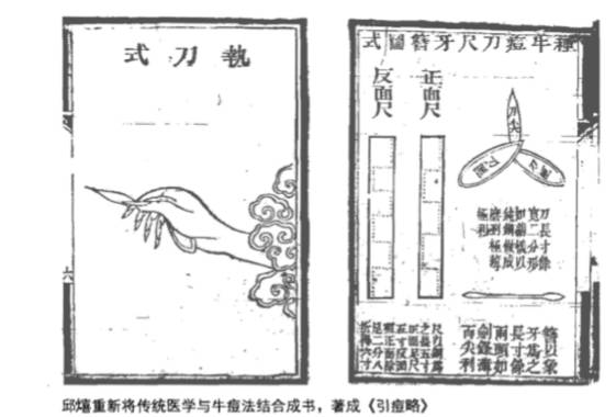 邱熺重新将传统医学与牛痘法结合成书,著成《引痘略》。