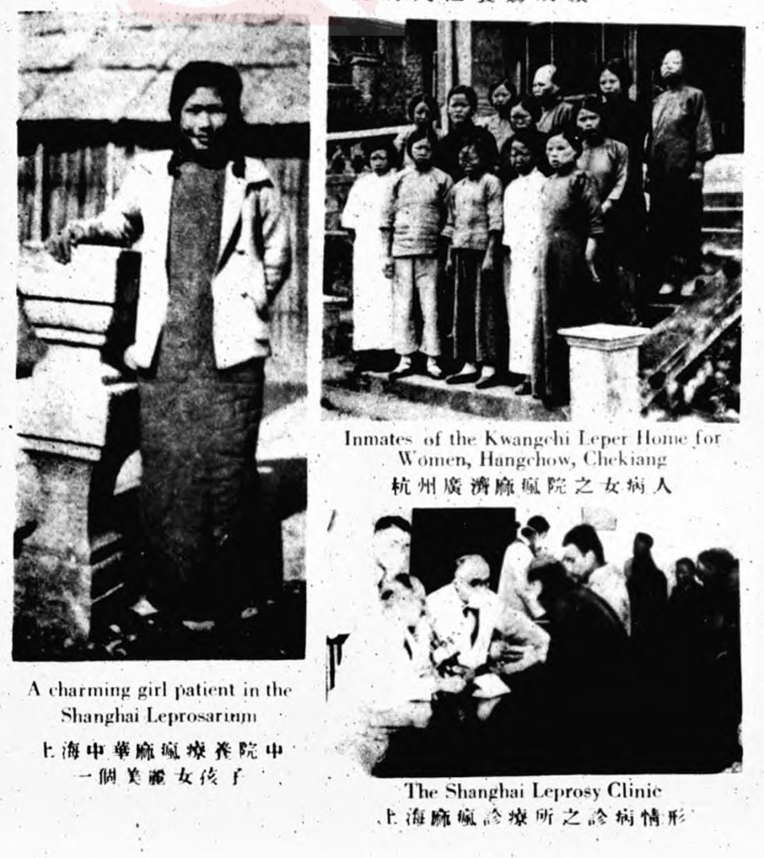 上海、杭州等地的麻疯院病人照片